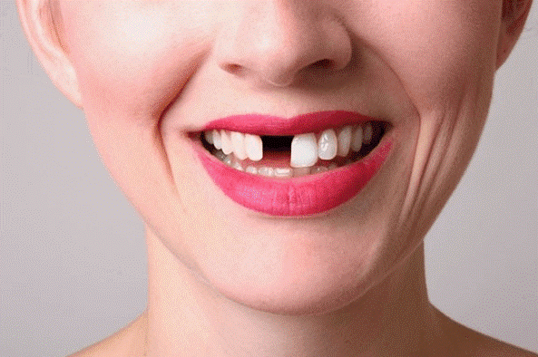 mơ thấy rụng răng mơ thấy rụng răng