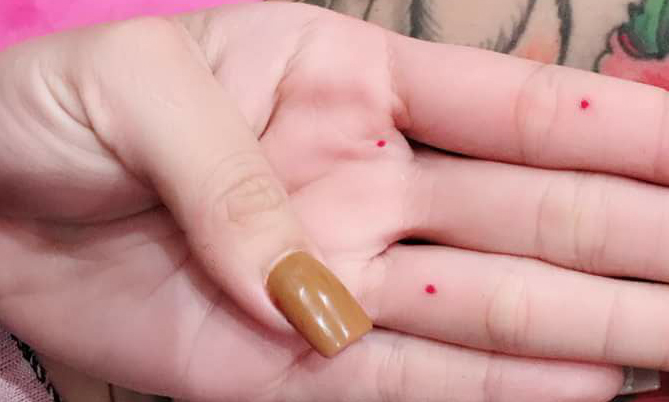 Không nên xem thường nốt ruồi son trong lòng bàn tay Không nên xem thường nốt ruồi son trong lòng bàn tay