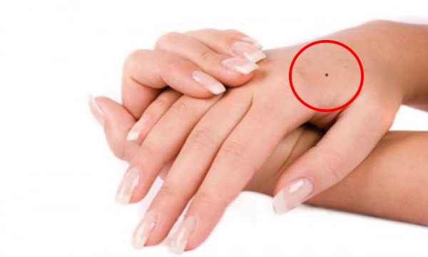 HÌnh ảnh nốt ruồi có nhiều ý nghĩa khác nhau HÌnh ảnh nốt ruồi có nhiều ý nghĩa khác nhau